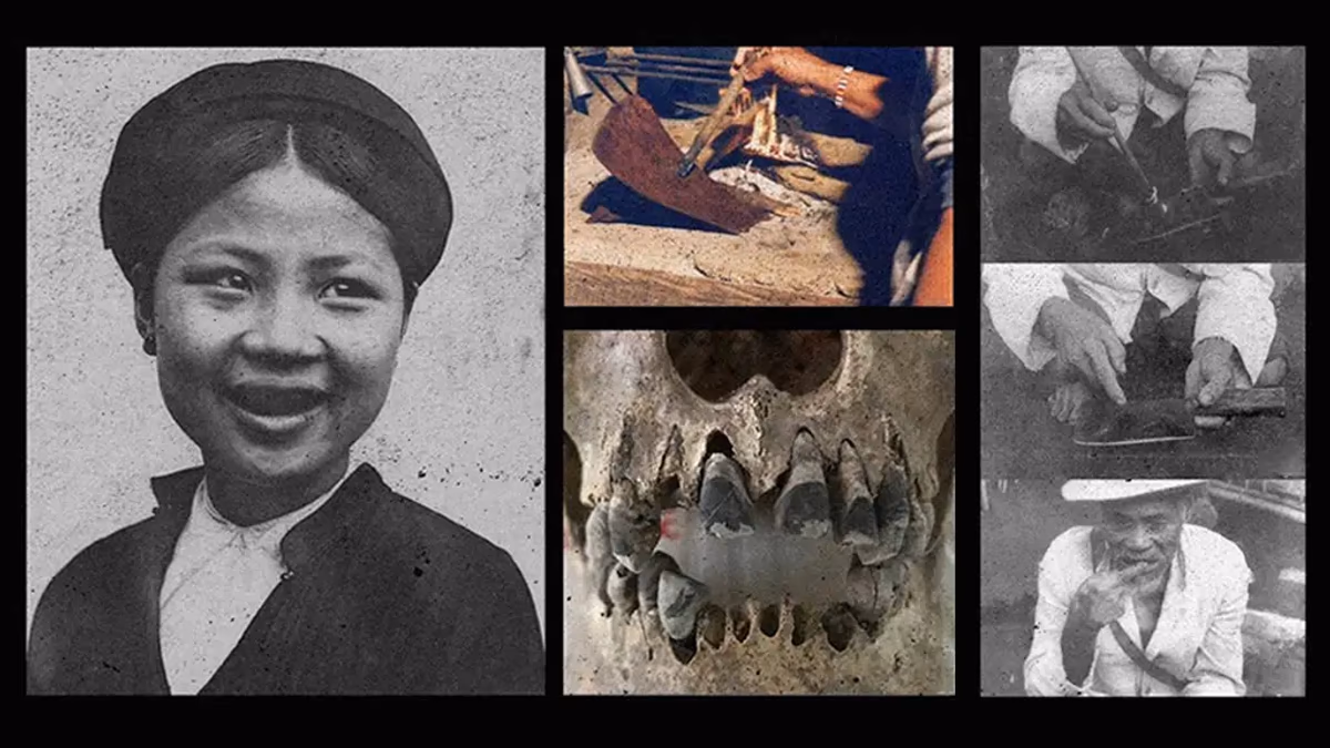 Por que e como vietnamitas antigos pintavam dentes de preto