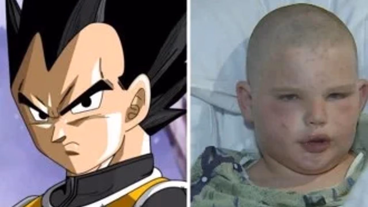 Menino sobrevive a ataque de abelhas com ‘técnica do Vegeta’
